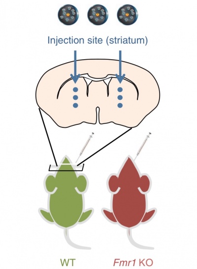 Nanoparticle delivery of CRISPR into the brain rescues a mouse model of fragile X syndrome from exaggerated repetitive behaviours